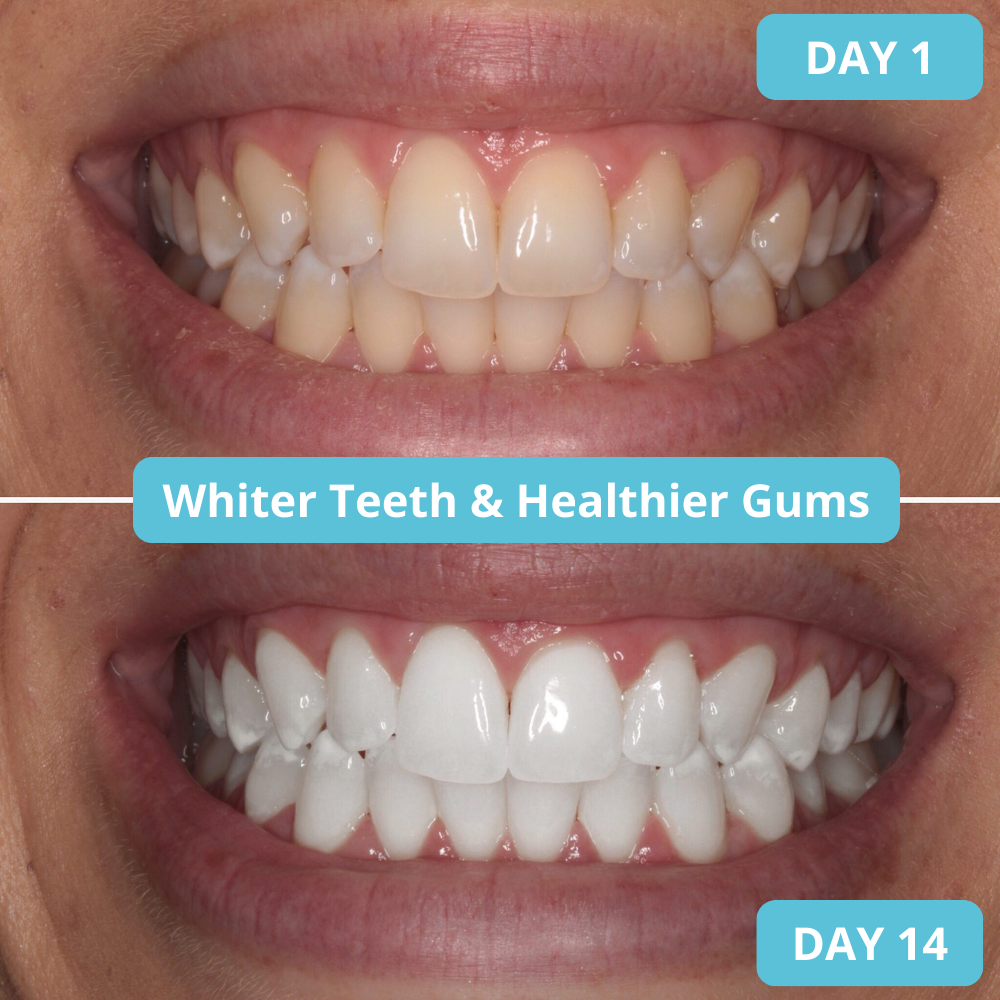 Lumora Remineralizing Gum